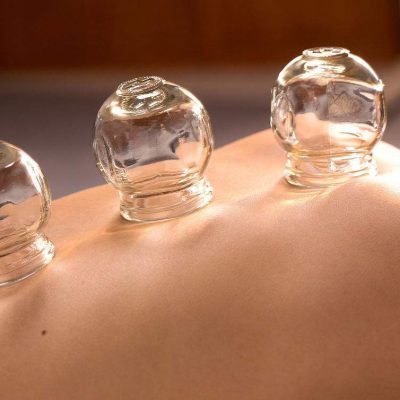 Cupping2